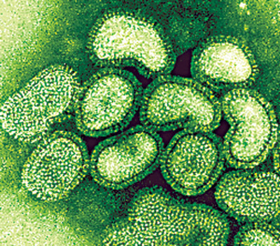 Autoridades de EEUU insta a eliminar el consumo preventivo de Tamiflu Autoridades de EEUU insta a eliminar el consumo preventivo de Tamiflu