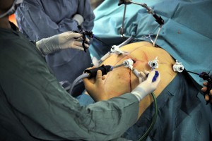 Weight-Loss-Surgery