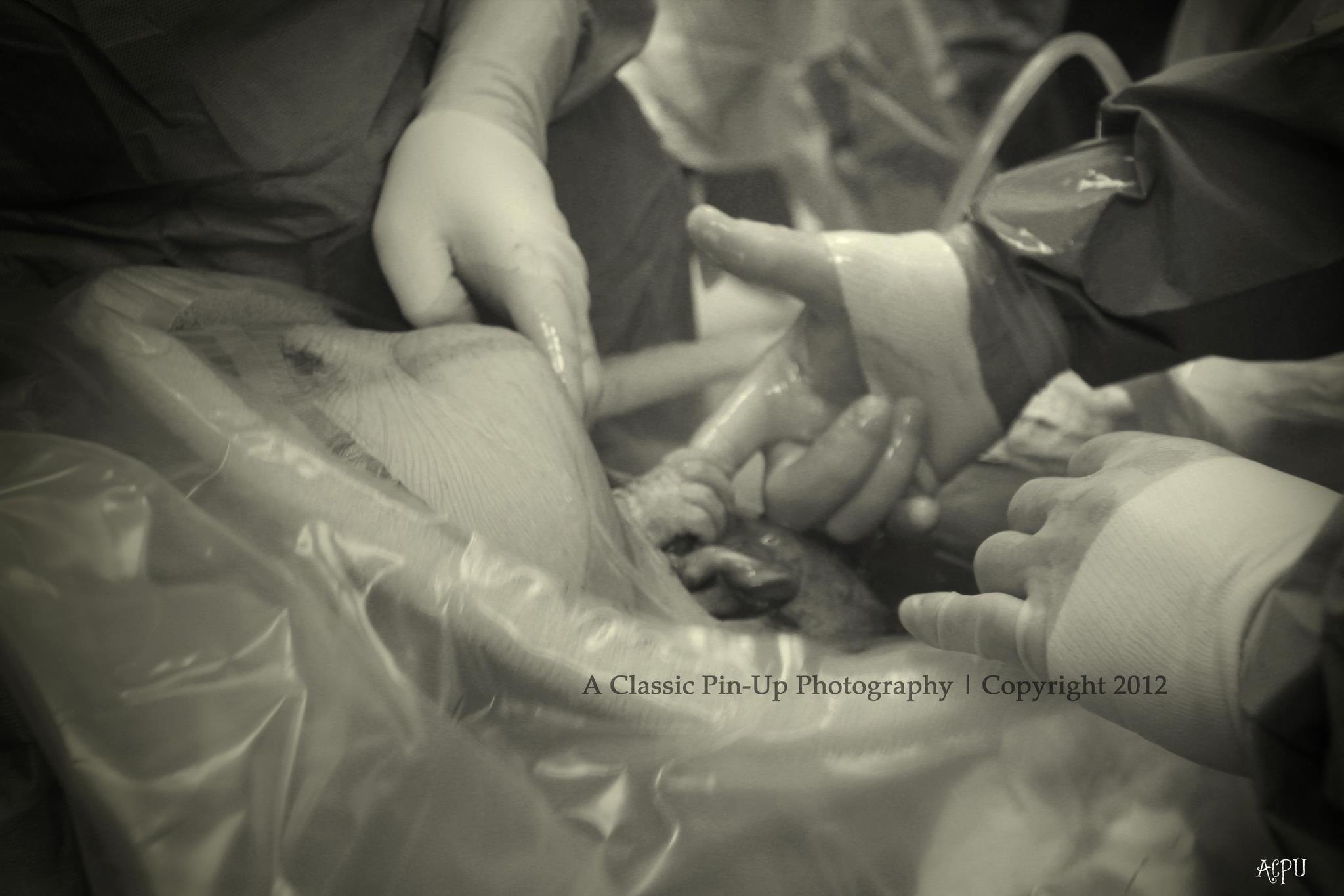 Hermosa imagen de la mano de un bebe aferrando la de medico durante cesarea da la vuelta al mundo Hermosa imagen de la mano de un bebe aferrando la de medico durante cesarea da la vuelta al mundo