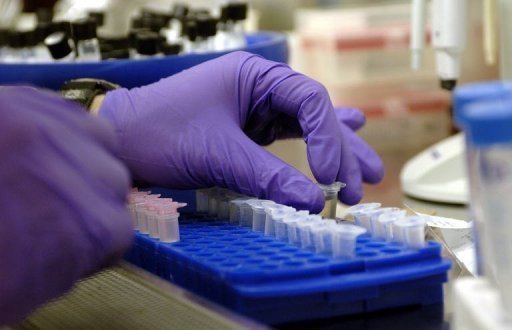 Científicos españoles hallan vacuna que controlar el virus del sida temporalmente Científicos españoles hallan vacuna que controlar el virus del sida temporalmente
