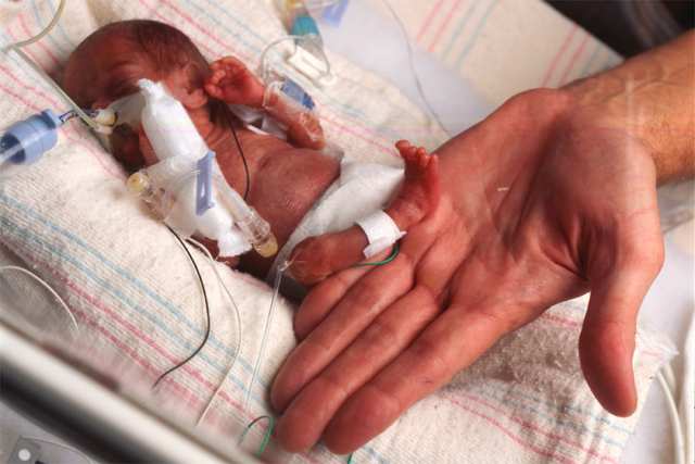 Un estudio hospitalario interestatal determinó que la mayoría de los partos prematuros son innecesarios Un estudio hospitalario interestatal determinó que la mayoría de los partos prematuros son innecesarios