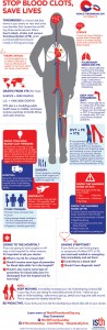 En esta infografia se pueden observar los tipos de coágulos que se pueden formar en partes del cuerpo como pulmón y piernas, llamados también, Tromboembolismo venoso (VTE, por sus siglas en ingles), el tercer asesino cardiovascular a nivel mundial, actual causa de fallecimientos prematuros, una enfermedad previsible y que muestra síntomas que si se reconocen a tiempo puede salvar vidas.