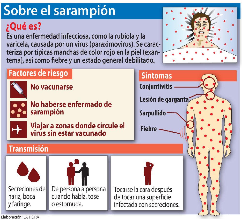 Las autoridades de salud en Arizona dicen que casi mil personas podrían haberse expuesto al sarampión Las autoridades de salud en Arizona dicen que casi mil personas podrían haberse expuesto al sarampión