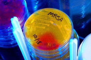 Una de las seis bacterias resistentes a los antibióticos consideradas una amenaza es la Staphylococcus aureus resistentes a la meticilina (SARM)